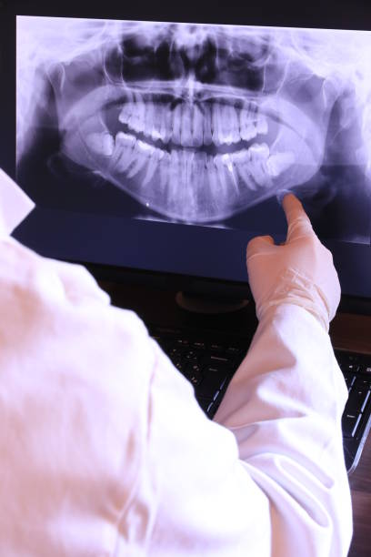 Best Emergency Wisdom Tooth Extraction in Bogalusa, LA